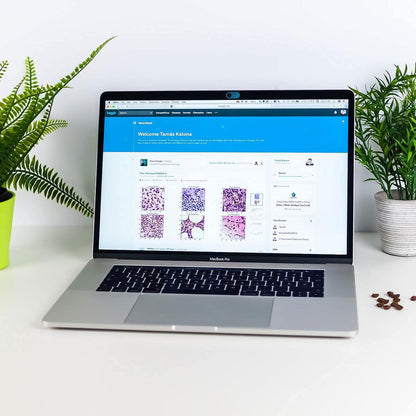 CloudValley Camera Cover Slide Ultra-Thin, Blue Webcam Cover for MacBook air, Laptop, iMac, Desktop, PC, MacBook Pro, iPad, iPhone 8/7/6, Privacy Web Camera Protection [2 Packs]