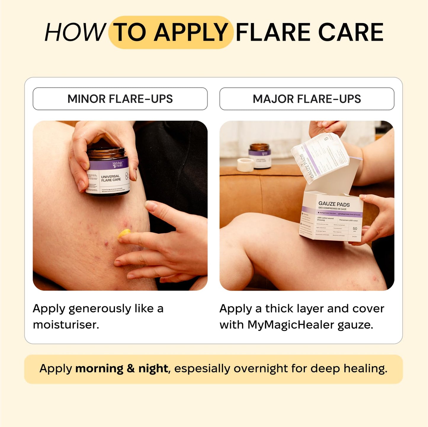 Universal Flare Care | Relief for 97% of Skin Issues | Cysts, Inflamed Skin, Hidradenitis Suppurativa, Abscesses, Impetigo | All Natural Flare Up Solution With Propolis & Egg Yolk Extract 4 oz