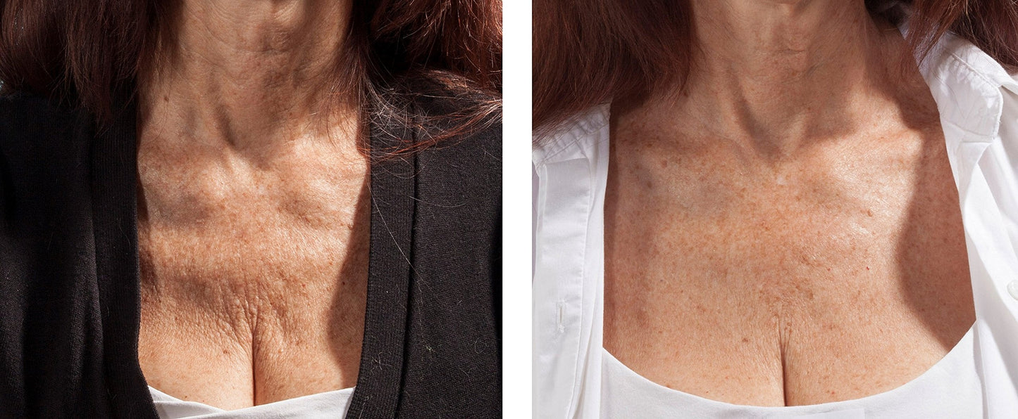 Bravity Women Anti-Wrinkle Cleavage Sleep Bra/Seamless & Adjustable Beige Size Small